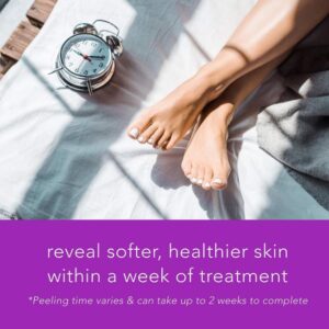 Alternative view of Paquete de 4 calcetines exfoliantes para los pies unitalla- Barefoot Scientist